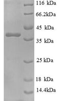 Recombinant Human Nephrocystin-1 (NPHP1), partial – Figure 1 of 1