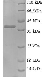Recombinant Human Nephrocystin-1 (NPHP1), partial – Figure 1 of 1