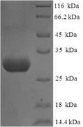 Recombinant Human Nephrin (NPHS1), partial – Figure 1 of 1