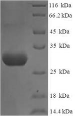 Recombinant Human Nephrin (NPHS1), partial – Figure 1 of 1