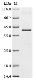 (Tris-Glycine gel) Discontinuous SDS-PAGE (reduced) with 5% enrichment gel and 15% separation gel.