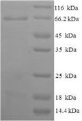 Recombinant Human Atrial natriuretic peptide receptor 1 (NPR1), partial – Figure 1 of 1