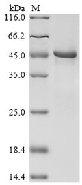 (Tris-Glycine gel) Discontinuous SDS-PAGE (reduced) with 5% enrichment gel and 15% separation gel.