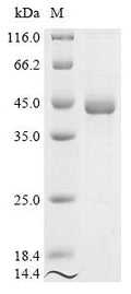 (Tris-Glycine gel) Discontinuous SDS-PAGE (reduced) with 5% enrichment gel and 15% separation gel.