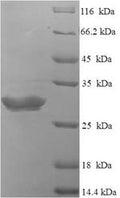 Recombinant Human Neurotensin/neuromedin N (NTS), partial – Figure 1 of 1