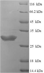 Recombinant Human Neurotensin/neuromedin N (NTS), partial – Figure 1 of 1
