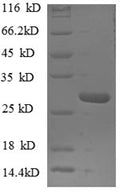 Recombinant Human Nuclear pore complex protein Nup153 (NUP153), partial – Figure 1 of 1