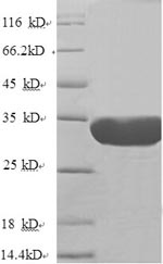 Recombinant Human Nuclear pore membrane glycoprotein 210 (NUP210), partial – Figure 1 of 1