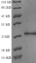 Recombinant Human Nuclear pore membrane glycoprotein 210 (NUP210), partial – Figure 1 of 1