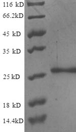 Recombinant Human Nuclear pore membrane glycoprotein 210 (NUP210), partial – Figure 1 of 1