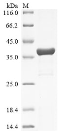 (Tris-Glycine gel) Discontinuous SDS-PAGE (reduced) with 5% enrichment gel and 15% separation gel.