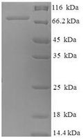 Recombinant Human Nuclear RNA export factor 3 (NXF3) – Figure 1 of 1