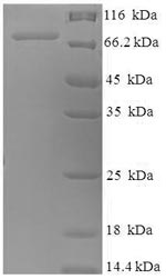 Recombinant Human Nuclear RNA export factor 3 (NXF3) – Figure 1 of 1