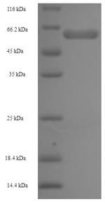 Recombinant Human 2-oxoglutarate dehydrogenase, mitochondrial (OGDH) – Figure 1 of 1