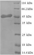 Recombinant Human Mimecan (OGN) – Figure 1 of 1