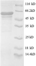 Recombinant Human UDP-N-acetylglucosamine--peptide N-acetylglucosaminyltransferase 110 kDa subunit (OGT), partial – Figure 1 