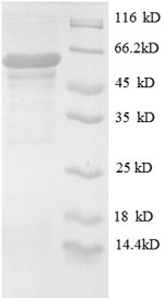 Recombinant Human UDP-N-acetylglucosamine--peptide N-acetylglucosaminyltransferase 110 kDa subunit (OGT), partial – Figure 1 