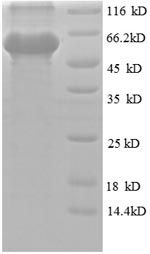 Recombinant Human Obg-like ATPase 1 (OLA1) – Figure 1 of 1
