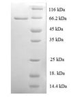 Recombinant Human Origin recognition complex subunit 4 (ORC4) – Figure 1 of 1