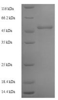 Recombinant Human Ornithine transcarbamylase, mitochondrial (OTC) – Figure 1 of 1