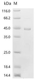 (Tris-Glycine gel) Discontinuous SDS-PAGE (reduced) with 5% enrichment gel and 15% separation gel.