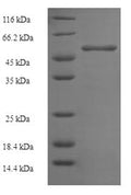 Recombinant Mouse Ornithine transcarbamylase, mitochondrial (Otc) – Figure 1 of 1