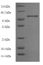 Recombinant Mouse Ornithine transcarbamylase, mitochondrial (Otc) – Figure 1 of 1