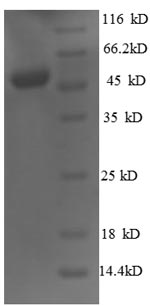 Recombinant Human Homeobox protein OTX2 (OTX2) – Figure 1 of 1