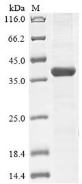 (Tris-Glycine gel) Discontinuous SDS-PAGE (reduced) with 5% enrichment gel and 15% separation gel.
