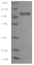 Recombinant Human Succinyl-CoA:3-ketoacid-coenzyme A transferase 1, mitochondrial (OXCT1) – Figure 1 of 1