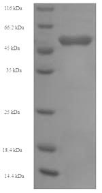 Recombinant Human Succinyl-CoA:3-ketoacid-coenzyme A transferase 1, mitochondrial (OXCT1) – Figure 1 of 1