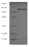 Recombinant Human Protein disulfide-isomerase (P4HB) – Figure 1 of 1