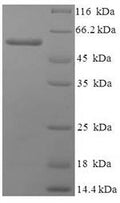 Recombinant Human Polyadenylate-binding protein 1 (PABPC1), partial – Figure 1 of 1