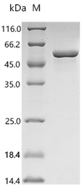 (Tris-Glycine gel) Discontinuous SDS-PAGE (reduced) with 5% enrichment gel and 15% separation gel.
