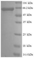 Recombinant Human Serine/threonine-protein kinase PAK 4 (PAK4) – Figure 1 of 1