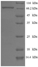 Recombinant Human E3 ubiquitin-protein ligase parkin (PRKN) – Figure 1 of 1