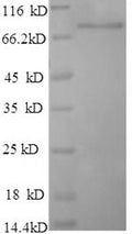 Recombinant Human Poly (A)-specific ribonuclease PARN (PARN) – Figure 1 of 1