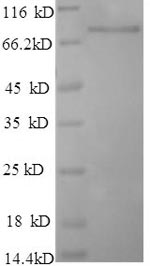 Recombinant Human Poly (A)-specific ribonuclease PARN (PARN) – Figure 1 of 1