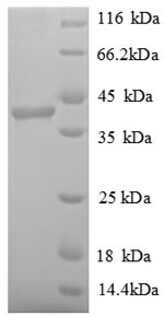 Recombinant Human Poly [ADP-ribose] polymerase 1 (PARP11), partial – Figure 1 of 1