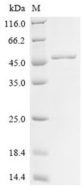 (Tris-Glycine gel) Discontinuous SDS-PAGE (reduced) with 5% enrichment gel and 15% separation gel.
