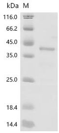 Recombinant Human Paired box protein Pax-8 (PAX8), partial – Figure 1 of 1