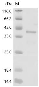 Recombinant Human Paired box protein Pax-8 (PAX8), partial – Figure 1 of 1