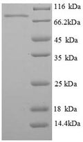 Recombinant Human Phosphoenolpyruvate carboxykinase, cytosolic [GTP] (PCK1) – Figure 1 of 1