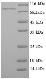 Recombinant Human Phosphoenolpyruvate carboxykinase, cytosolic [GTP] (PCK1) – Figure 1 of 1