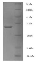 Recombinant Human Proliferating cell nuclear antigen (PCNA) – Figure 1 of 1