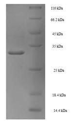 Recombinant Human Proliferating cell nuclear antigen (PCNA) – Figure 1 of 1