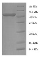 Recombinant Mouse Proprotein convertase subtilisin/kexin type 5 (Pcsk5) – Figure 1 of 1