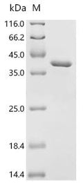 (Tris-Glycine gel) Discontinuous SDS-PAGE (reduced) with 5% enrichment gel and 15% separation gel.
