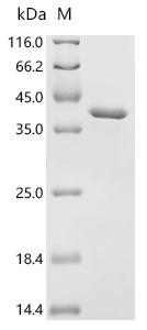 (Tris-Glycine gel) Discontinuous SDS-PAGE (reduced) with 5% enrichment gel and 15% separation gel.