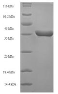 Recombinant Escherichia coli Peptide deformylase (def) – Figure 1 of 1